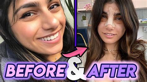 are mia khalifa boobs real|Mia Khalifa gets new nose job as she makes admission about fake boobs